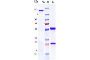 Anti-IGF1R / CD221 Reference Antibody (lonigutamAb) on SDS-PAGE under reducing (R) condition. (Recombinant IGF1R (Lonigutamab Biosimilar) 抗体)