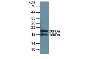 Western blot analysis of recombinant Human IL1RAP. (IL1RAP 抗体  (AA 420-558))