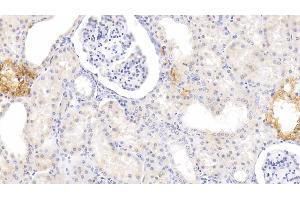 Detection of MTNR1A in Human Kidney Tissue using Polyclonal Antibody to Melatonin Receptor 1A (MTNR1A) (Melatonin Receptor 1A 抗体  (AA 296-350))