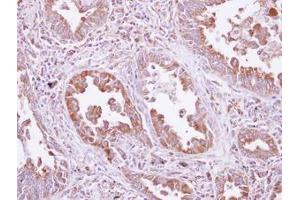 Image no. 1 for anti-Aspartyl-tRNA Synthetase (DARS) (AA 304-501) antibody (ABIN1497768) (DARS 抗体  (AA 304-501))
