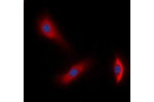 Immunofluorescent analysis of HER3 staining in A549 cells. (ERBB3 抗体  (C-Term))