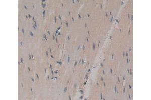 Used in DAB staining on fromalin fixed paraffin- embedded Kidney tissue (UCK2 抗体  (AA 18-261))