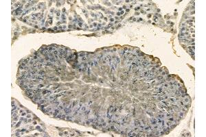 Integrin alpha E Mouse Monoclonal Antibody at 1/100 staining rat testis tissue by IHC-P.