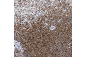 Immunohistochemical staining of human spleen with PSD4 polyclonal antibody  shows strong cytoplasmic positivity in cells of white pulp. (PSD4 抗体)