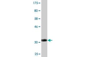 Western Blotting (WB) image for anti-Solute Carrier Family 2 (Facilitated Glucose Transporter), Member 10 (SLC2A10) (AA 325-382) antibody (ABIN529334)