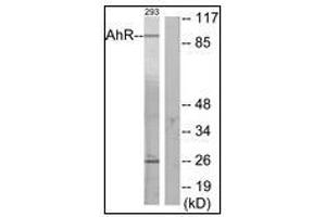 Western blot analysis of extracts from 293 cells, using AhR Antibody. (Aryl Hydrocarbon Receptor 抗体  (N-Term))