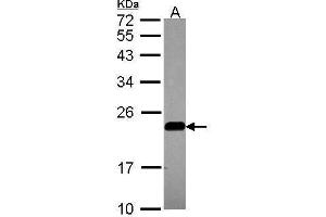 WB Image Sample (30 ug of whole cell lysate) A: A549 12% SDS PAGE antibody diluted at 1:1000 (Caveolin 2 抗体  (N-Term))