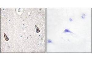 Immunohistochemistry analysis of paraffin-embedded human brain tissue, using ADCY5/6 Antibody. (ADCY5/6 抗体  (AA 931-980))