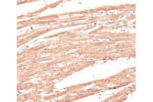 Immunohistochemistry of paraffin-embedded Rat heart using KIF1C Polyclonal Antibody at dilution of 1:100 (40x lens). (KIF1C 抗体)