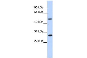 WB Suggested Anti-ZNF556 Antibody Titration:  0.