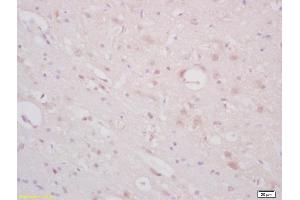 Formalin-fixed and paraffin embedded rat brain labeled with Anti-ST18/Znf387 Polyclonal Antibody, Unconjugated (ABIN1386039) at 1:200 followed by conjugation to the secondary antibody and DAB staining (ST18 抗体  (AA 451-550))