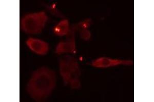 ABIN6275105 staining Hela cells by IF/ICC. (ELOVL1 抗体  (Internal Region))