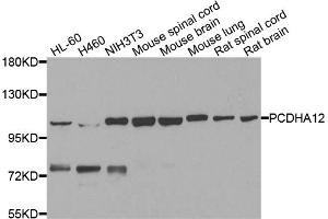 Western blot analysis of extracts of various cell lines, using PCDHA12 antibody. (PCDHA12 抗体)