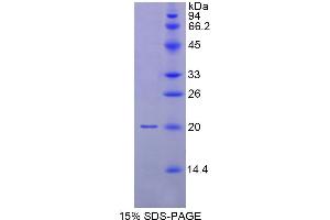 SDS-PAGE analysis of Human MYL9 Protein. (MYL9 蛋白)