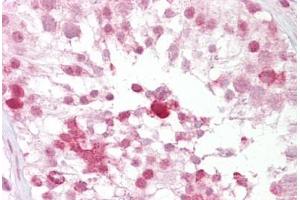 Anti-IFT88 antibody IHC staining of human testis. (IFT88 抗体  (N-Term))