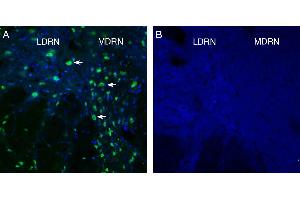 Expression of GPR4 in rat dorsal raphe nucleus (DRN). (GPR4 抗体  (Extracellular))