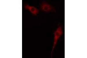 ABIN6274400 staining Hela cells by IF/ICC. (MAST2 抗体  (Internal Region))