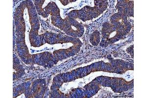 IHC analysis of FRY using anti-FRY antibody (ABIN7599716).