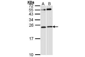 WB Image Sample (30 ug of whole cell lysate) A: Hela B: Raji 12% SDS PAGE antibody diluted at 1:1000 (RAC1 抗体  (Center))