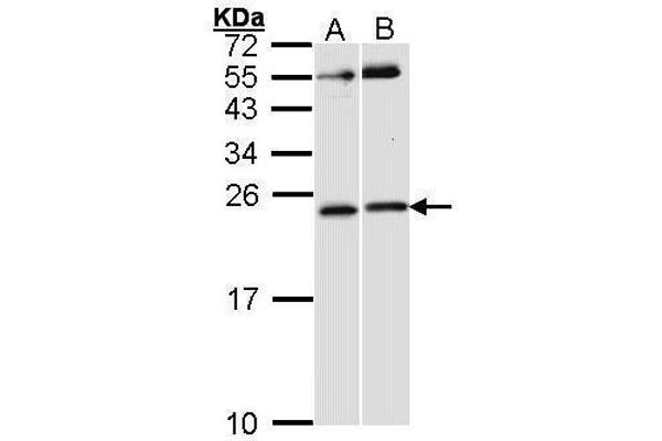 RAC1 antibody  (Center)