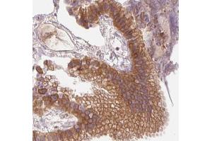 AMPK1 Antibody for IHC in human gallbladder tissue (PRKAA1 抗体  (C-Term))