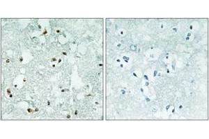 Immunohistochemistry analysis of paraffin-embedded human brain, using ELAC2 Antibody. (ELAC2 抗体  (AA 161-210))