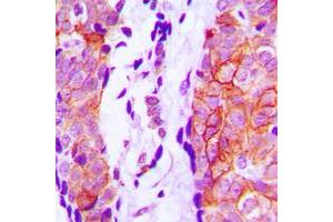 Immunohistochemical analysis of Cystatin 11 staining in human prostate formalin fixed paraffin embedded tissue section. (CST11 抗体  (Center))