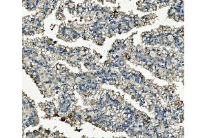 IHC analysis of Clathrin heavy chain/CLTC using anti-Clathrin heavy chain/CLTC antibody (ABIN7602703). (Clathrin Heavy Chain (CLTC) (AA 967-1668) 抗体)