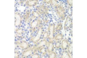 Immunohistochemistry of paraffin-embedded rat kidney using MAP2 antibody (ABIN5970171) at dilution of 1/200 (40x lens). (MAP2 抗体)