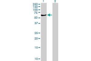 Western Blot analysis of SGSH expression in transfected 293T cell line by SGSH MaxPab polyclonal antibody. (SGSH 抗体  (AA 1-502))