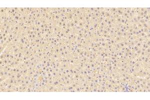 Detection of ARG in Rat Liver Tissue using Polyclonal Antibody to Arginase (ARG) (ARG 抗体  (AA 1-323))