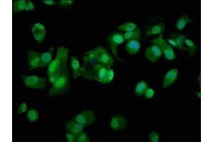 Immunofluorescence (IF) image for anti-Proteasome (Prosome, Macropain) 26S Subunit, Non-ATPase, 11 (PSMD11) (AA 2-422), (Regulatory Subunit 11) antibody (ABIN7142202)