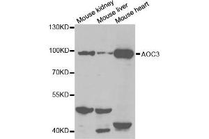 Western blot analysis of extracts of various cell lines, using AOC3 antibody. (AOC3 抗体  (AA 27-190))