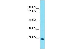Host:  Rabbit  Target Name:  Msx3  Sample Type:  Rat Lung lysates  Antibody Dilution:  1. (Homeobox, Msh-Like 3 (MSX3) (C-Term) 抗体)