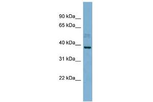 WB Suggested Anti-MARCH8 Antibody Titration:  0. (MARCH8 抗体  (N-Term))