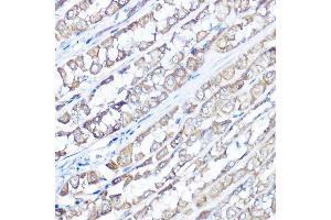 Immunohistochemistry of paraffin-embedded rat stomach using TRPV6 Rabbit pAb (ABIN7270921) at dilution of 1:100 (40x lens). (TRPV6 抗体  (AA 1-100))