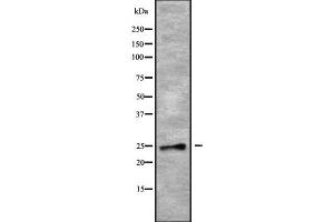 Western blot analysis of RAB28 using COLO205 whole cell lysates