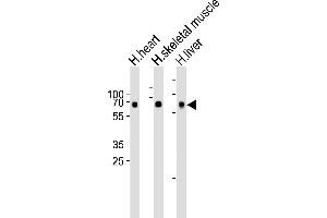 Western blot analysis of lysates from human heart, skeletal muscle and liver tissue lysate (from left to right), using Cry2 Antibody A. (CRY2 抗体  (C-Term))