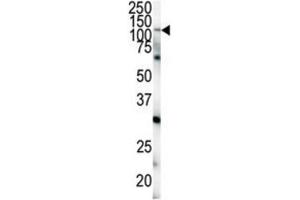 Western Blotting (WB) image for anti-EPH Receptor A4 (EPHA4) antibody (ABIN3003330) (EPH Receptor A4 抗体)