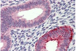 Uterus, Human: Formalin-Fixed, Paraffin-Embedded (FFPE) (FCHO1 抗体  (AA 468-517))