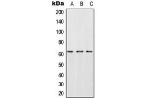 Western blot analysis of CES2 expression in HepG2 (A), SP2/0 (B), H9C2 (C) whole cell lysates. (CES2 抗体  (Center))