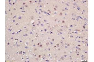 Formalin-fixed and paraffin embedded rat brain labeled with Rabbit Anti-SOD1 Polyclonal Antibody, Unconjugated  at 1:200 followed by conjugation to the secondary antibody and DAB staining (SOD1 抗体  (AA 6-100))