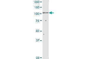 Western Blotting (WB) image for anti-Glucosidase, Alpha, Neutral AB (GANAB) (AA 1-944) antibody (ABIN950071)