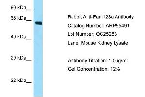 Western Blotting (WB) image for anti-APC Membrane Recruitment Protein 2 (AMER2) (N-Term) antibody (ABIN2786237) (AMER2 抗体  (N-Term))