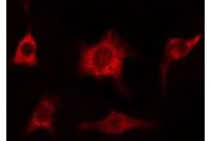 ABIN6274993 staining HeLa cells by IF/ICC. (CEP78 抗体  (Internal Region))