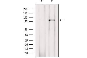 Western Blotting (WB) image for anti-RalA Binding Protein 1 (RALBP1) (N-Term) antibody (ABIN6264626)