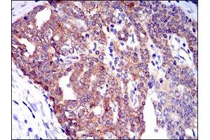 Image no. 2 for anti-Twinfilin, Actin-Binding Protein 1 (TWF1) antibody (ABIN1491429) (TWF1 抗体)