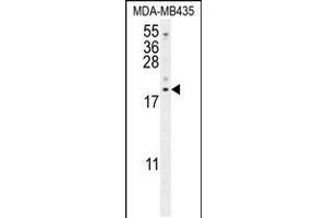Western blot analysis in MDA-MB435 cell line lysates (35ug/lane). (LYRM4 抗体  (AA 43-69))