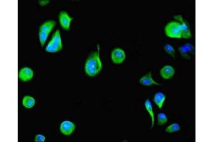 Immunofluorescent analysis of MCF-7 cells using ABIN7150796 at dilution of 1:100 and Alexa Fluor 488-congugated AffiniPure Goat Anti-Rabbit IgG(H+L) (DYRK4 抗体  (AA 201-520))