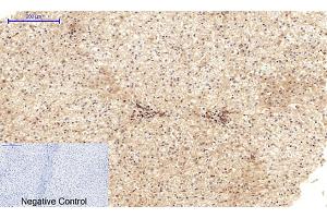 Immunohistochemical analysis of paraffin-embedded human liver tissue. (Cadherin 5 抗体  (Internal Region))
